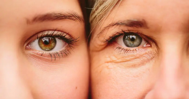  Premature skin aging