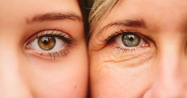 Premature skin aging