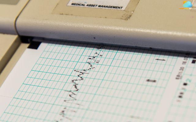 Magnitude scale of an earthquake